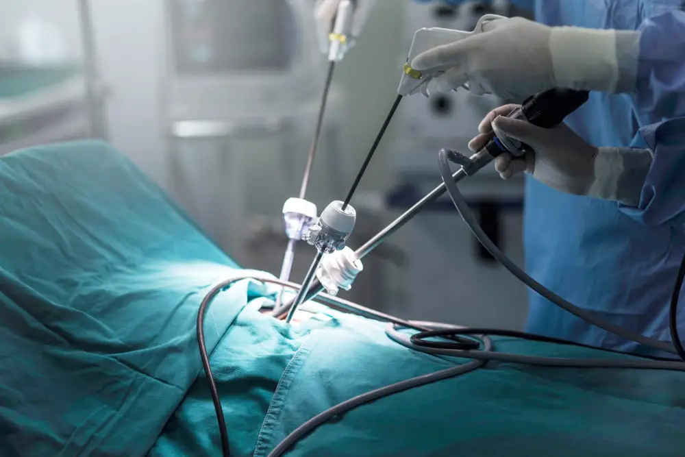 surgeons-holing-instrument-abdomen-patient-doing